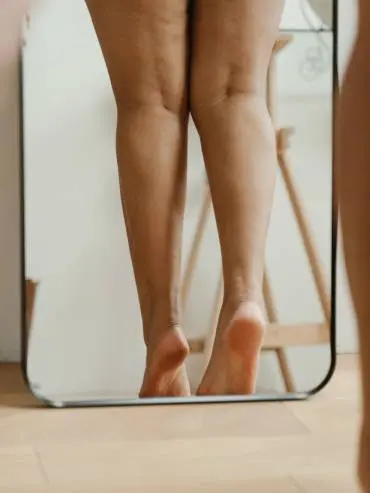Woman looking at legs in mirror, considering mesotherapy treatment