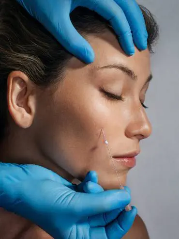 Receiving thread-lifts at Blemish Clinic in Ramsbottom