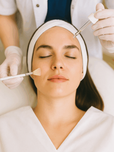 blemish clinic skin peel