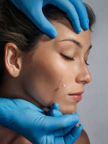 Receiving thread-lifts at Blemish Clinic in Ramsbottom