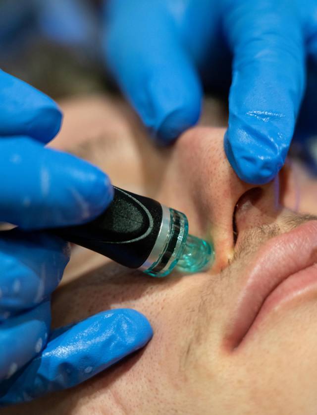 Man receiving HydraFacial treatment at Blemish Clinic.